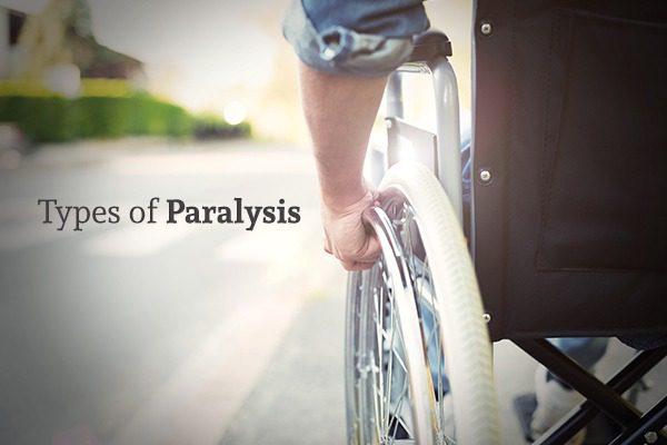 A man in a wheelchair beside the words types of paralysis