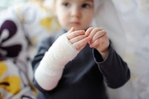 A child with an arm in a cast.