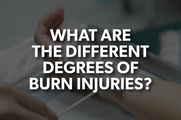 A person treating a burn with the words, "what are the different degrees of burn injuries?"
